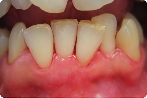 Periodontics, after