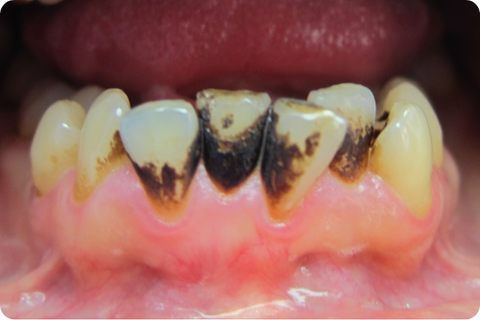 Periodontics, before