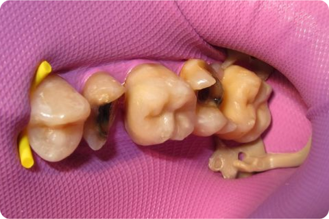 Biomimetic dentistry, before