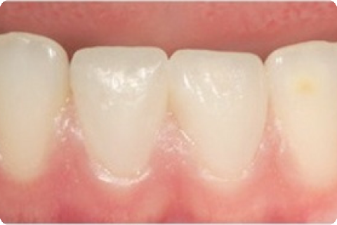 Microsurgery, after