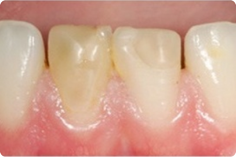 Microsurgery, before