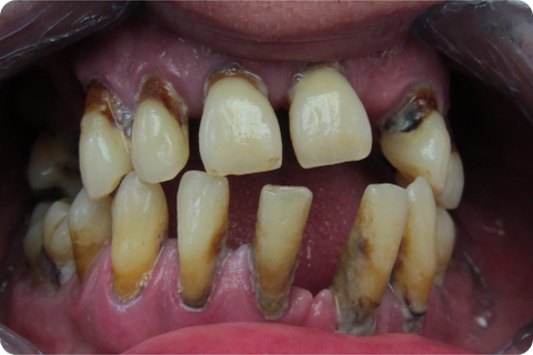 Complex case, before