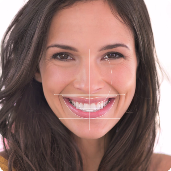 Aesthetic smile analysis